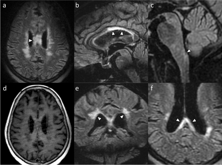 Fig. 1 