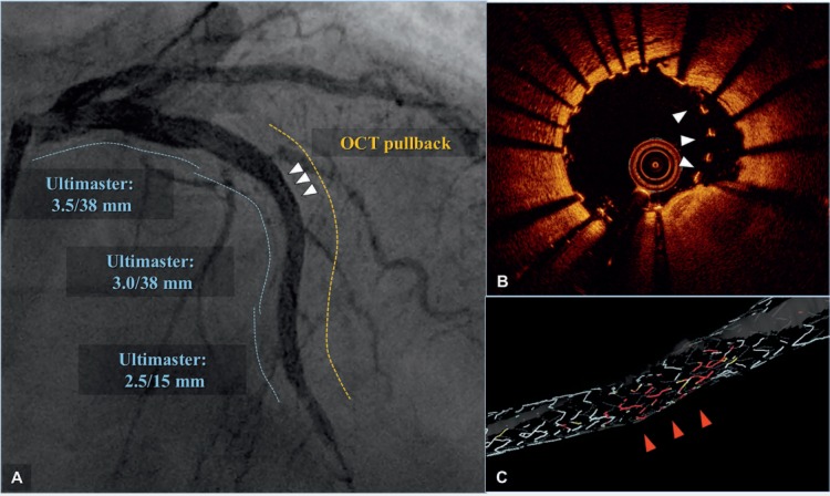 Figure 3 and Online Video 1.