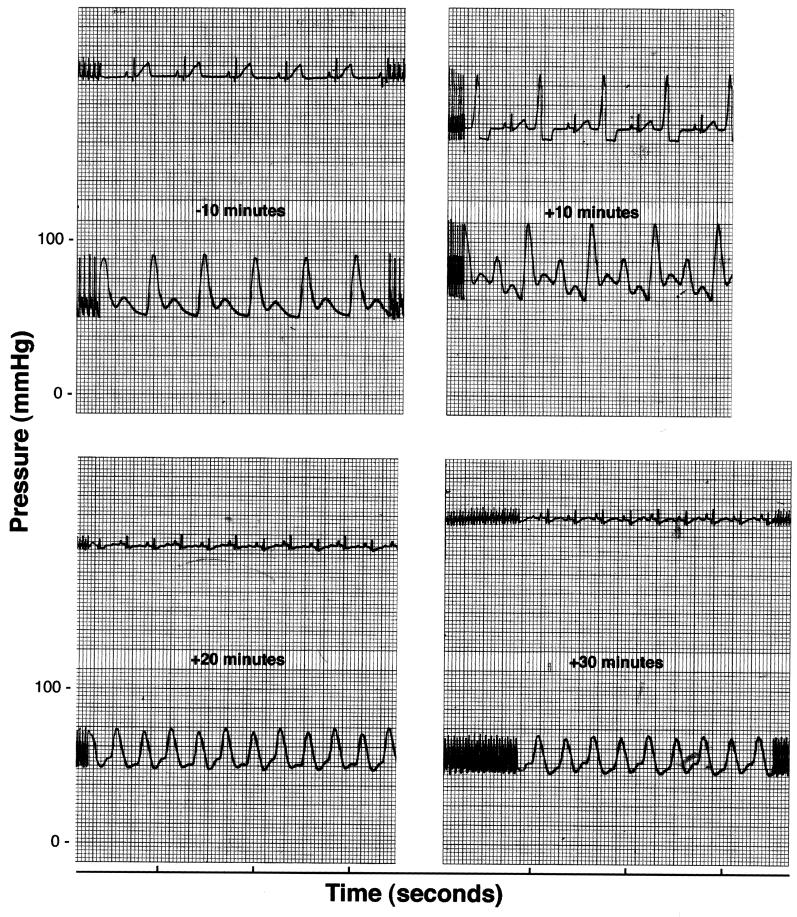 FIG. 3