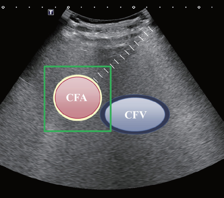 Fig. 2.