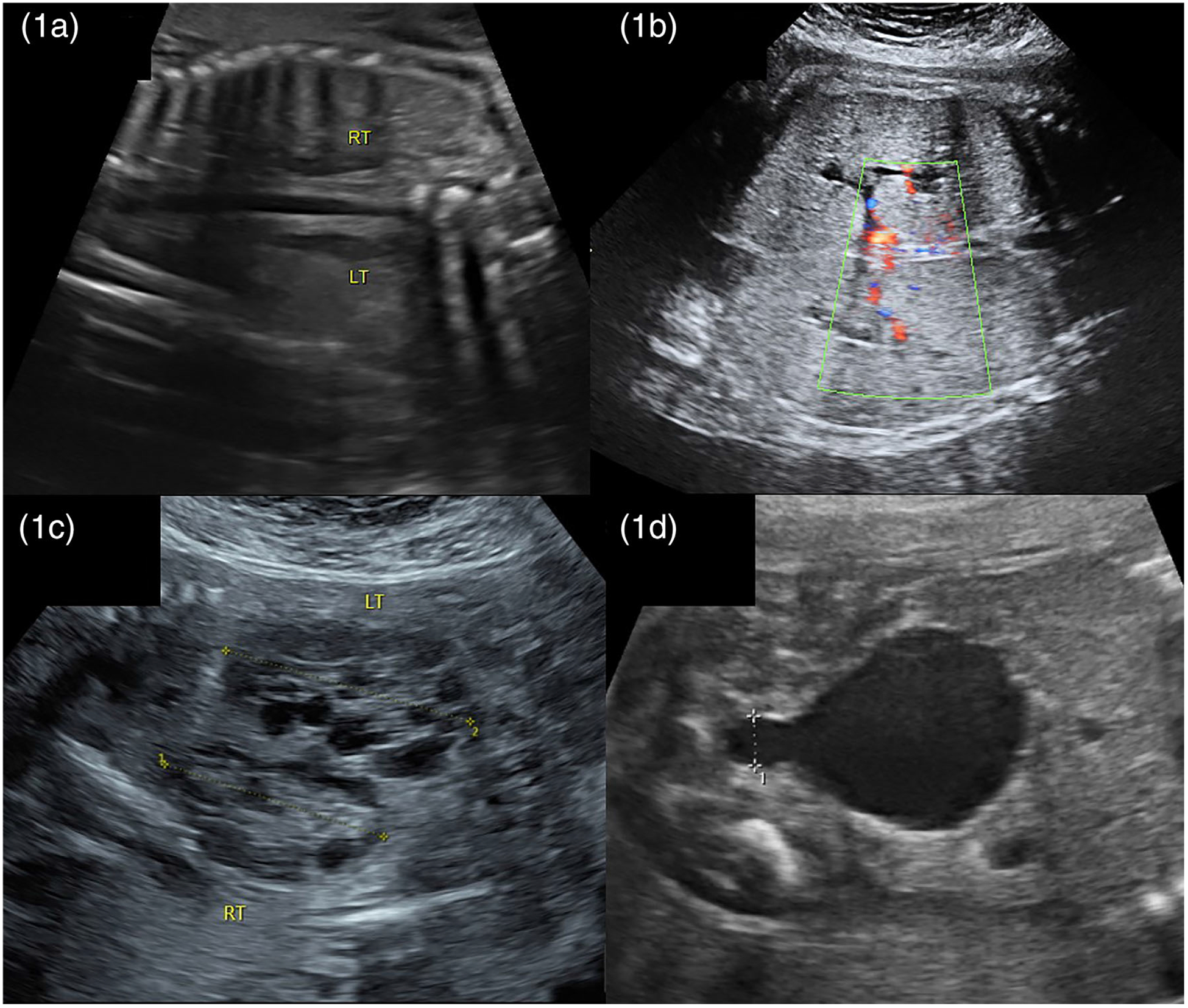 FIGURE 1