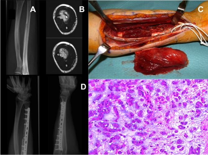 Fig. (1)