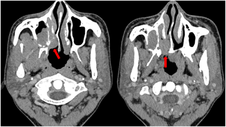 Fig. 3