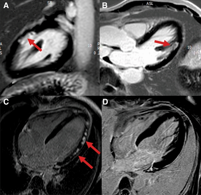 Figure 15