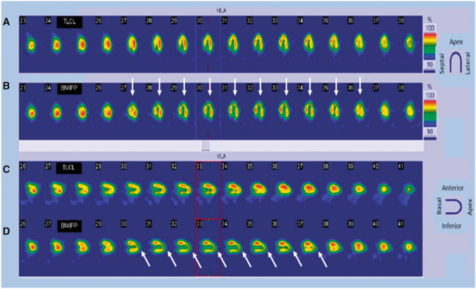 Figure 18