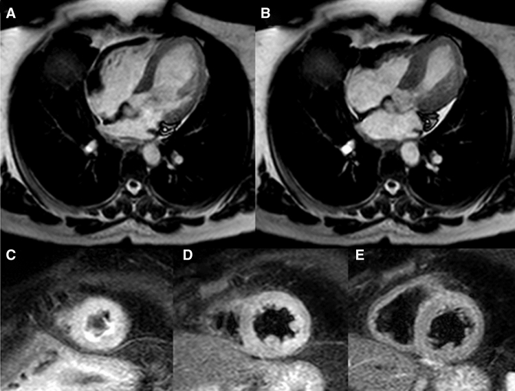 Figure 17