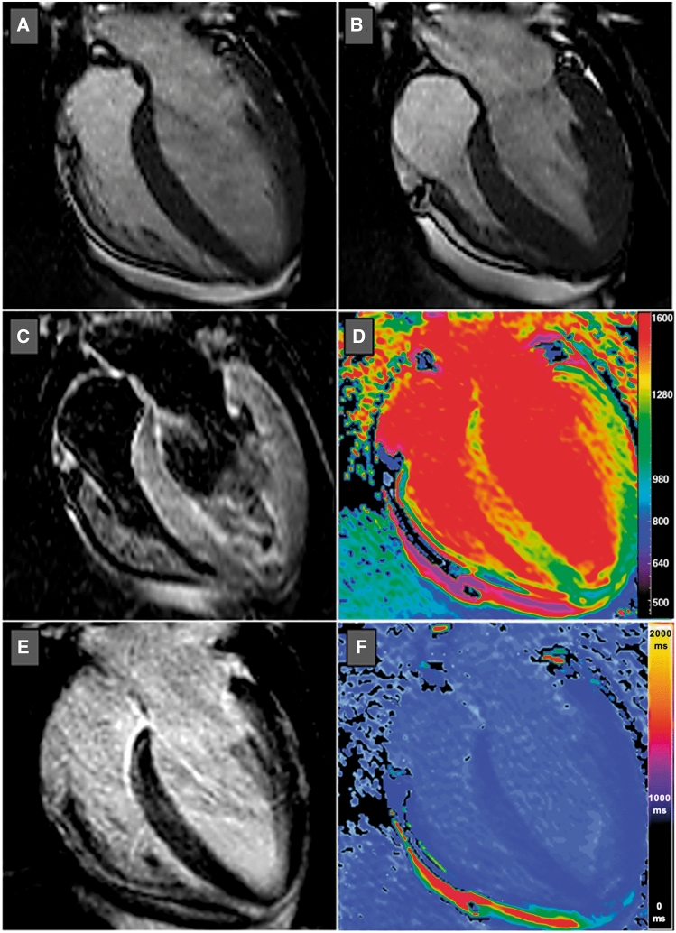 Figure 16