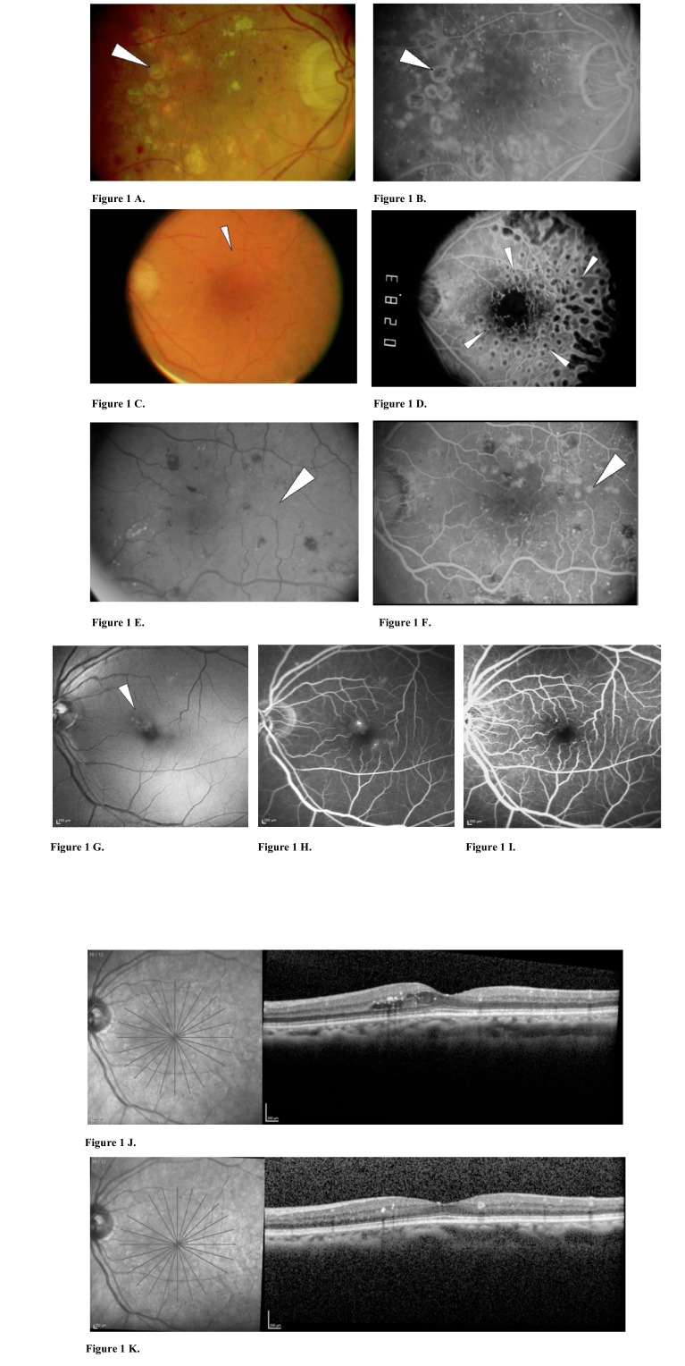 Fig. (1)