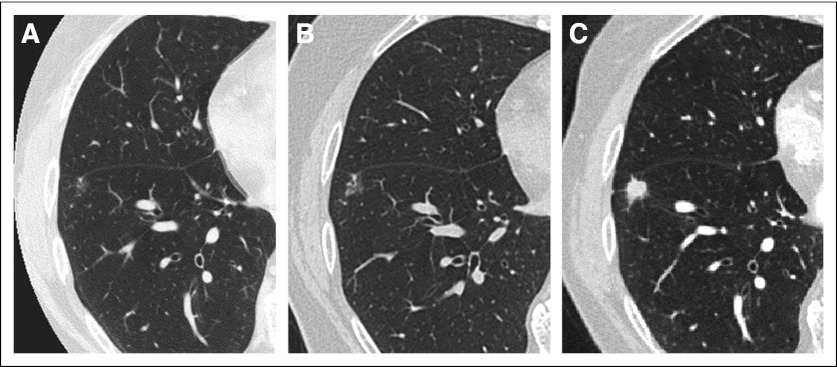 Fig 3.