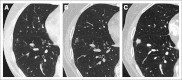 Fig 3.