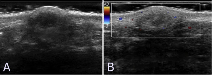 Fig. 6