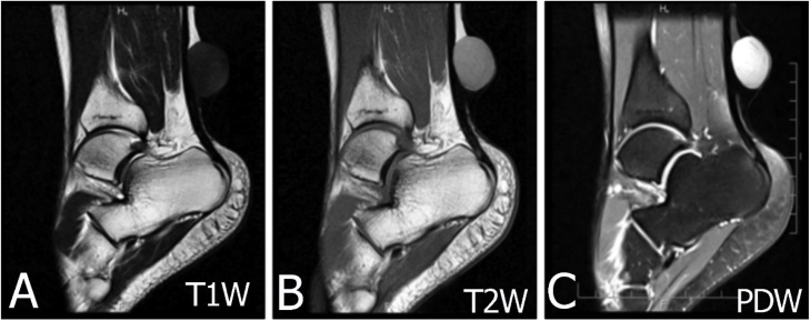 Fig. 11