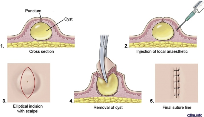 Fig. 14