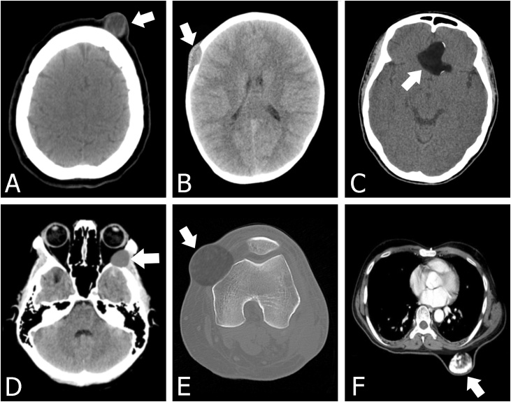 Fig. 9