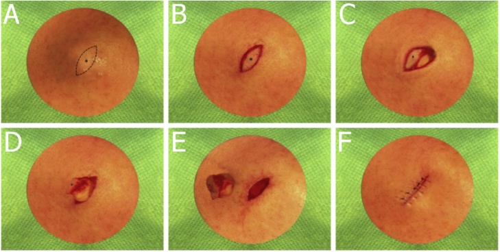 Fig. 15