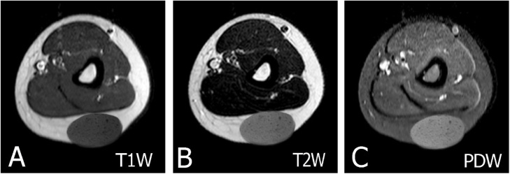 Fig. 13