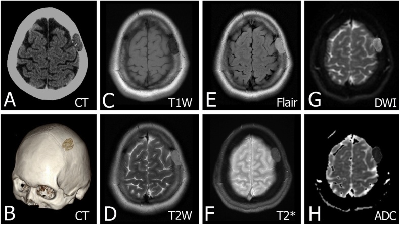 Fig. 10