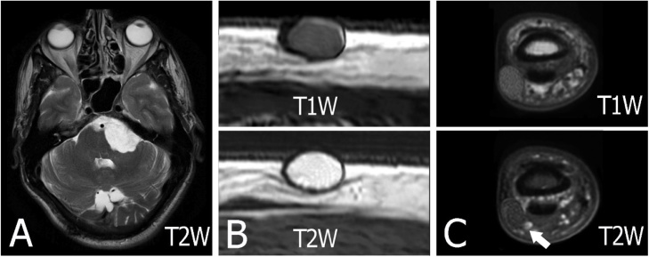 Fig. 12