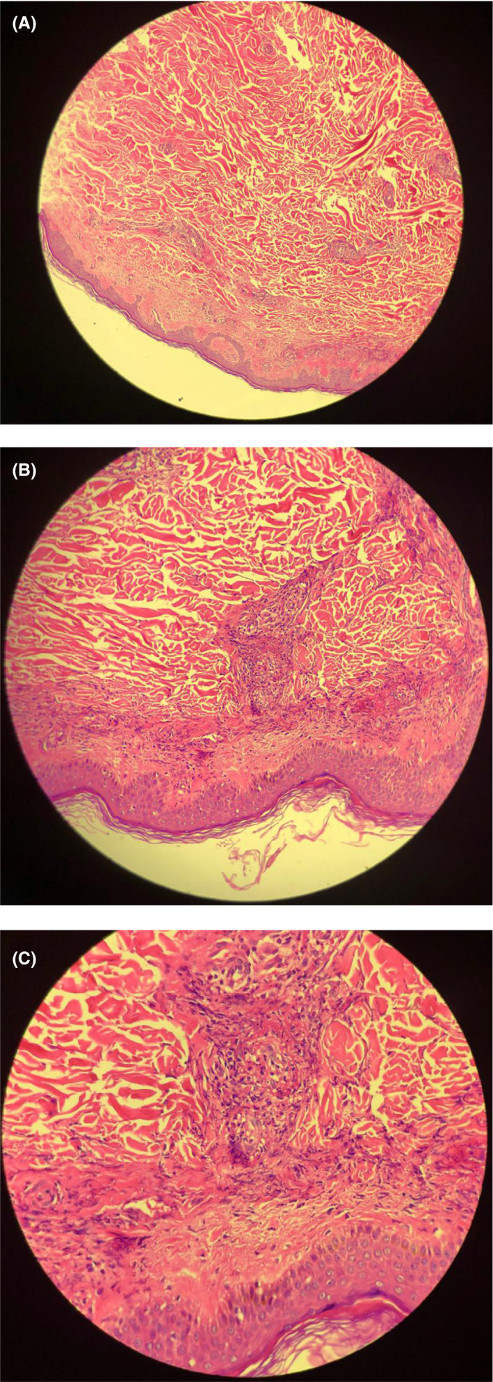 FIGURE 2