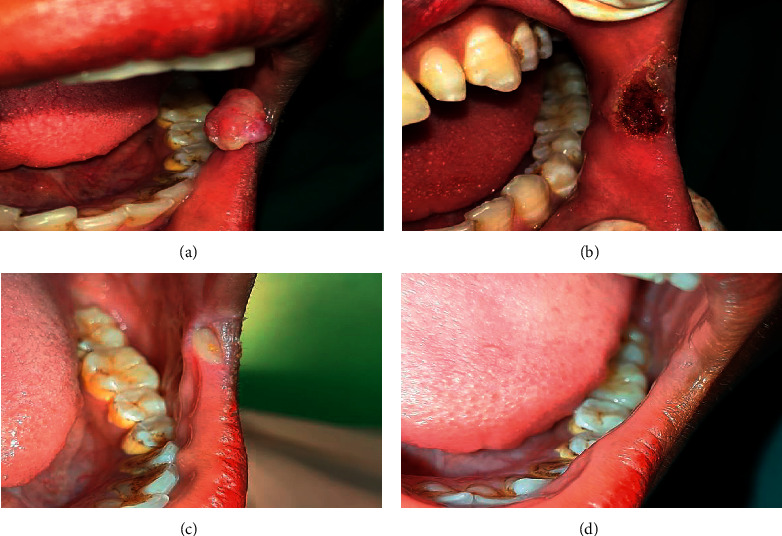 Figure 4