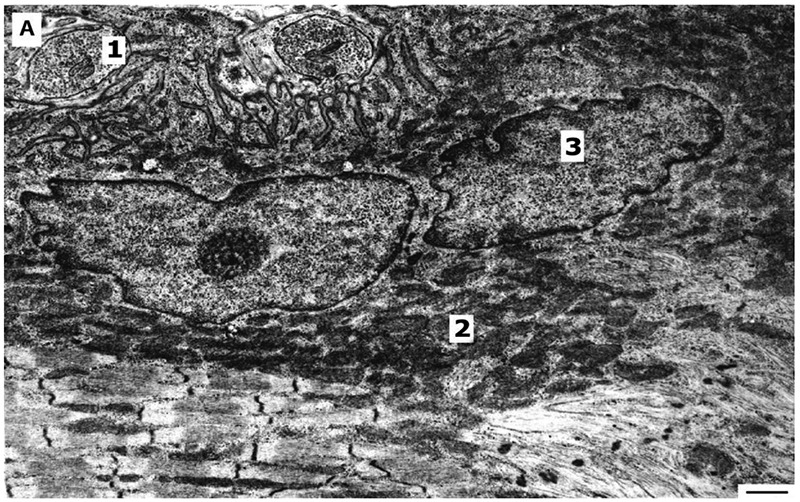 Fig. 4, A.