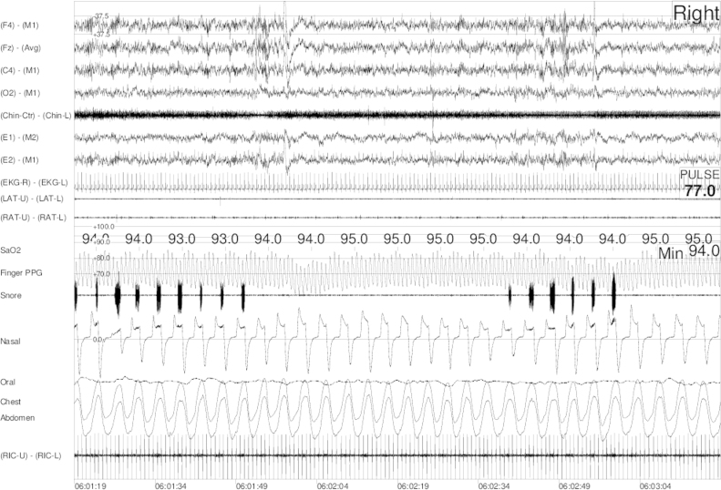 Fig. 6