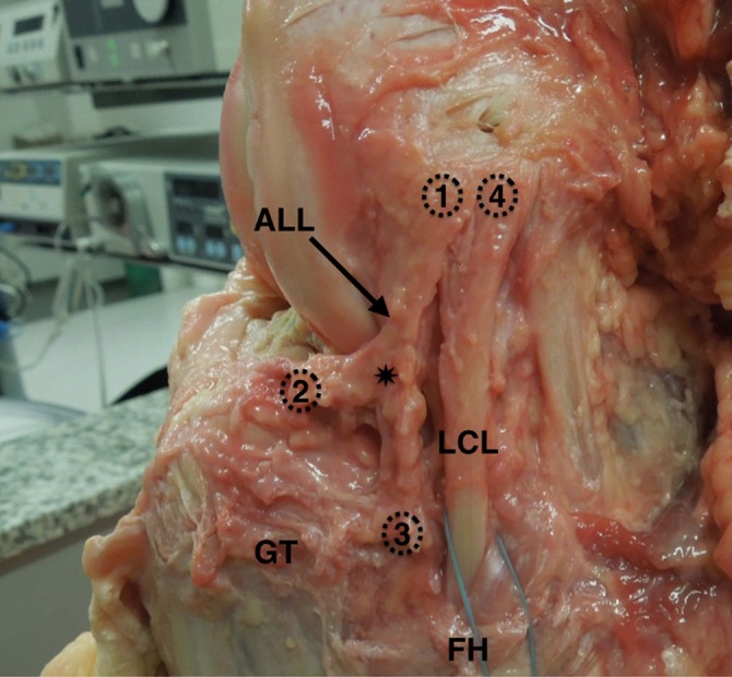 Figure 4.