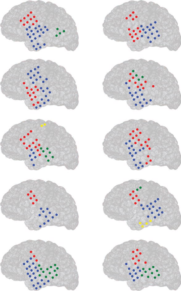 Figure 13