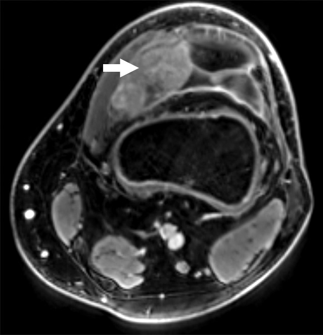 Figure 1c: