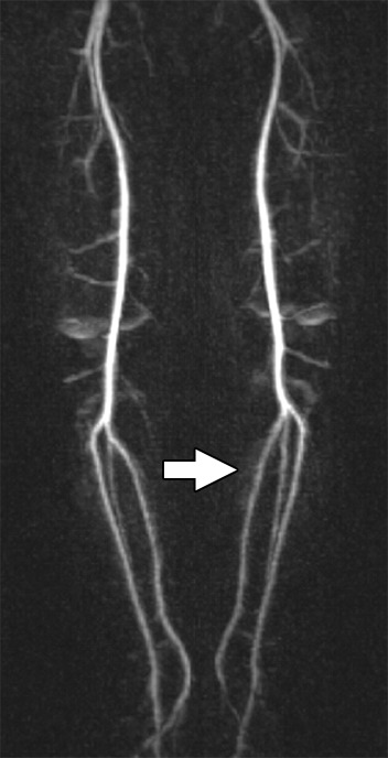 Figure 2e: