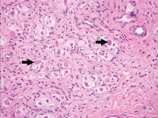 Figure 2f: