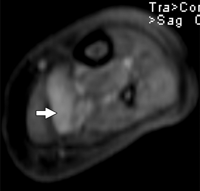 Figure 2c: