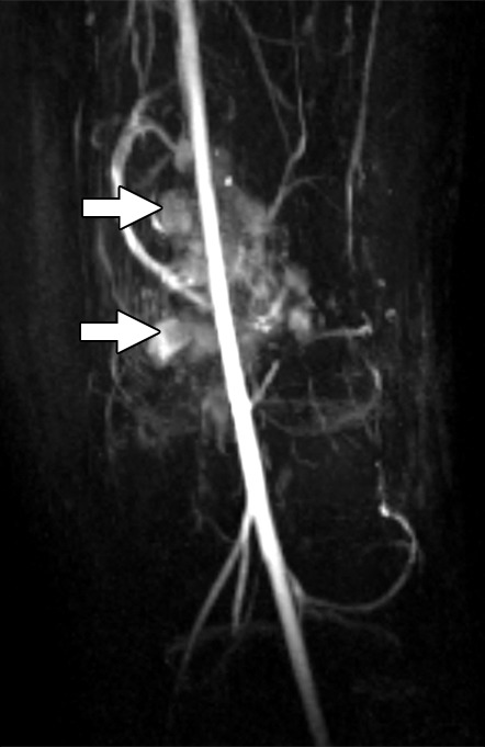 Figure 1e: