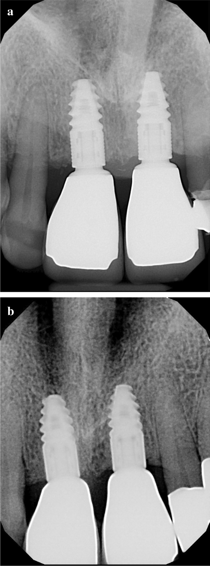 Fig. 10