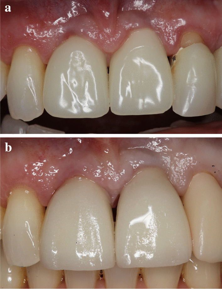 Fig. 9