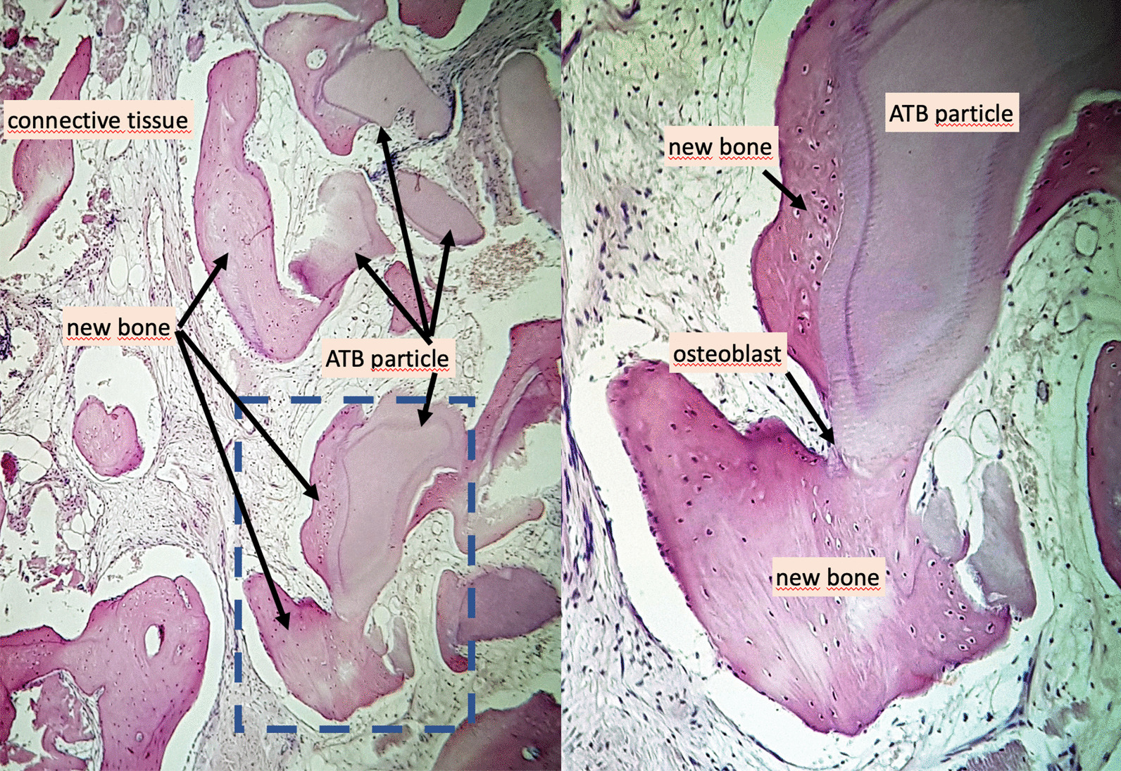 Fig. 11