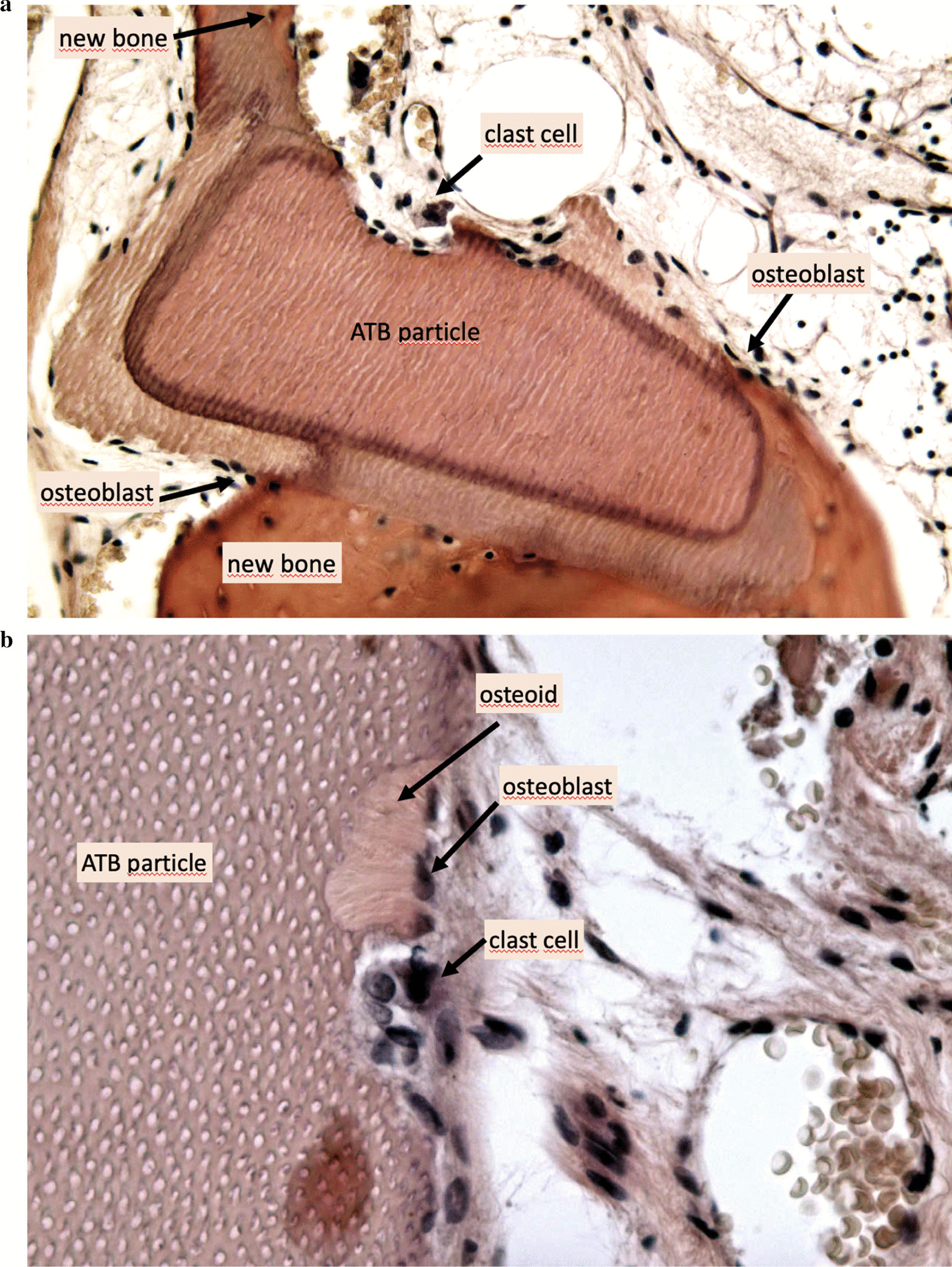 Fig. 12