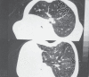 Fig. 1b)