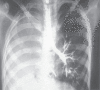 Fig. 1c)