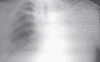 Fig. 2a)