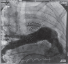 Fig. 2d)