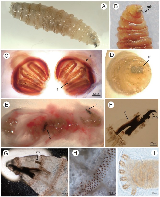 Human Chrysomya bezziana myiasis: A systematic review - PMC