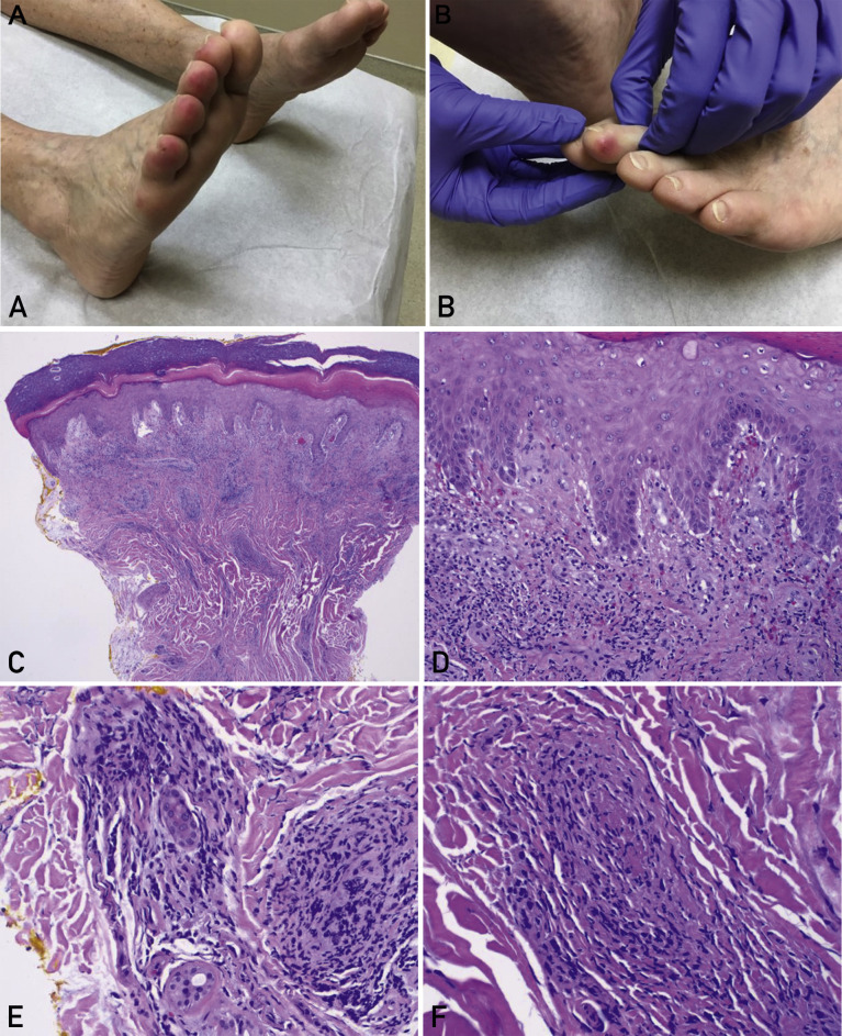 Figure 1