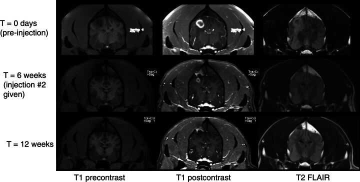 Figure 2. Dog 4 showing radiographic response to injection of 20 μg IACS-8779. Top row: baseline MR images; Bottom rows: congruent images at 6 weeks repeat MRI. From left to right: T1 precontrast axial, T1 postcontrast axial, and T2 FLAIR axial images.