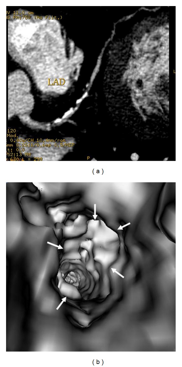 Figure 12