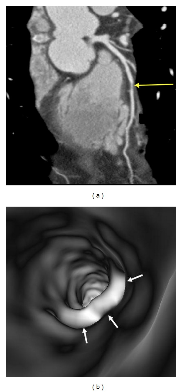 Figure 9