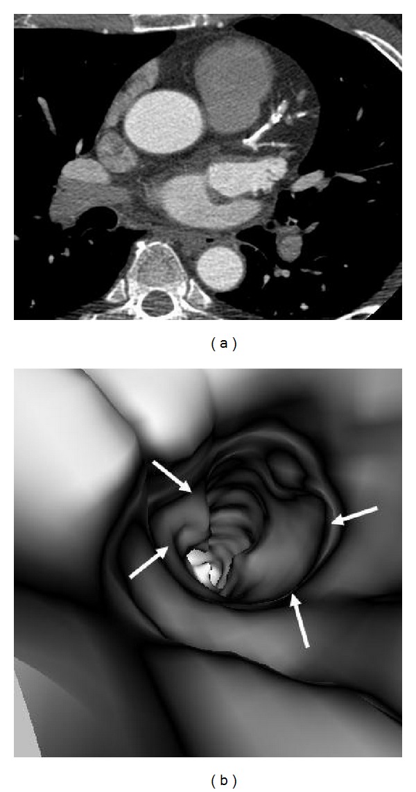 Figure 14