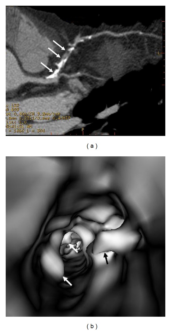 Figure 11