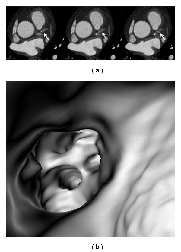 Figure 10