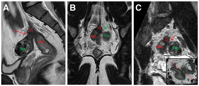 Figure 2.